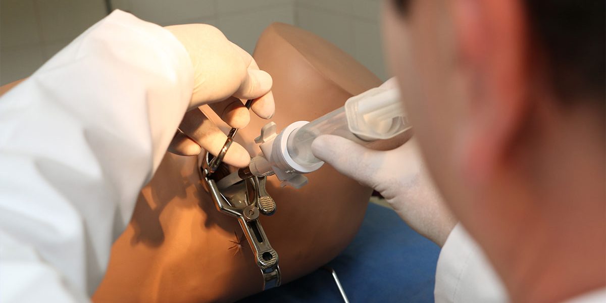 Aborto por aspiración Aborto por aspiración