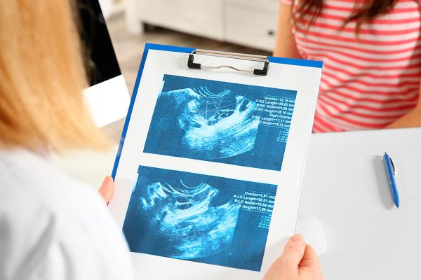 fertilidad-post-aborto